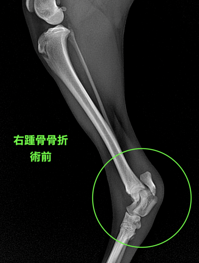 犬 後肢骨折（踵骨骨折） 骨折整復（テンションバンドワイヤー・TBW法 